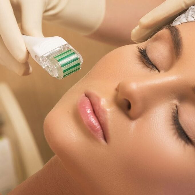 microneedling